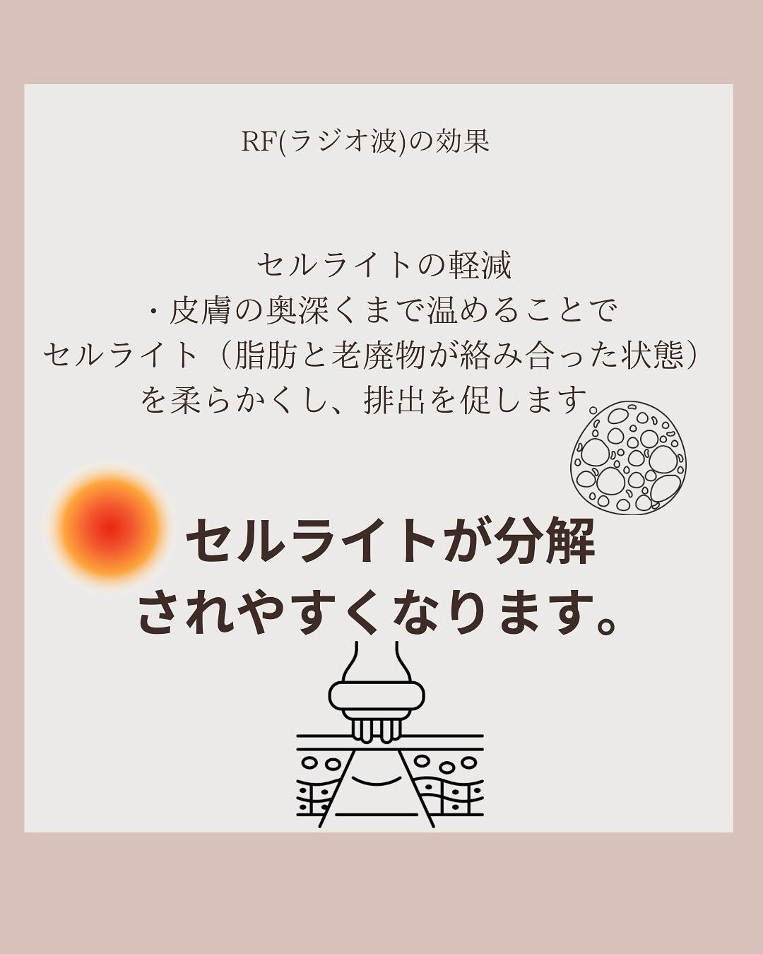 ラジオ波の効果についてと、